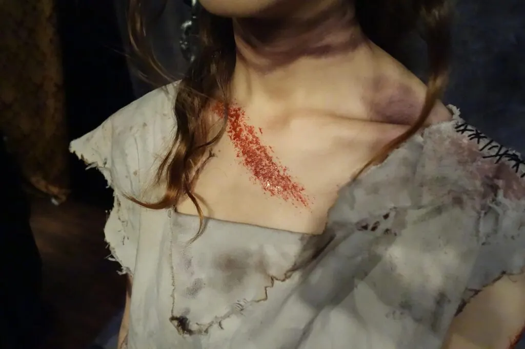 découvrez les histoires poignantes entourant des blessures dramatiques, des témoignages émouvants et les leçons de résilience qui en découlent. plongez dans un monde où chaque cicatrice raconte une bataille et une victoire sur l'adversité.